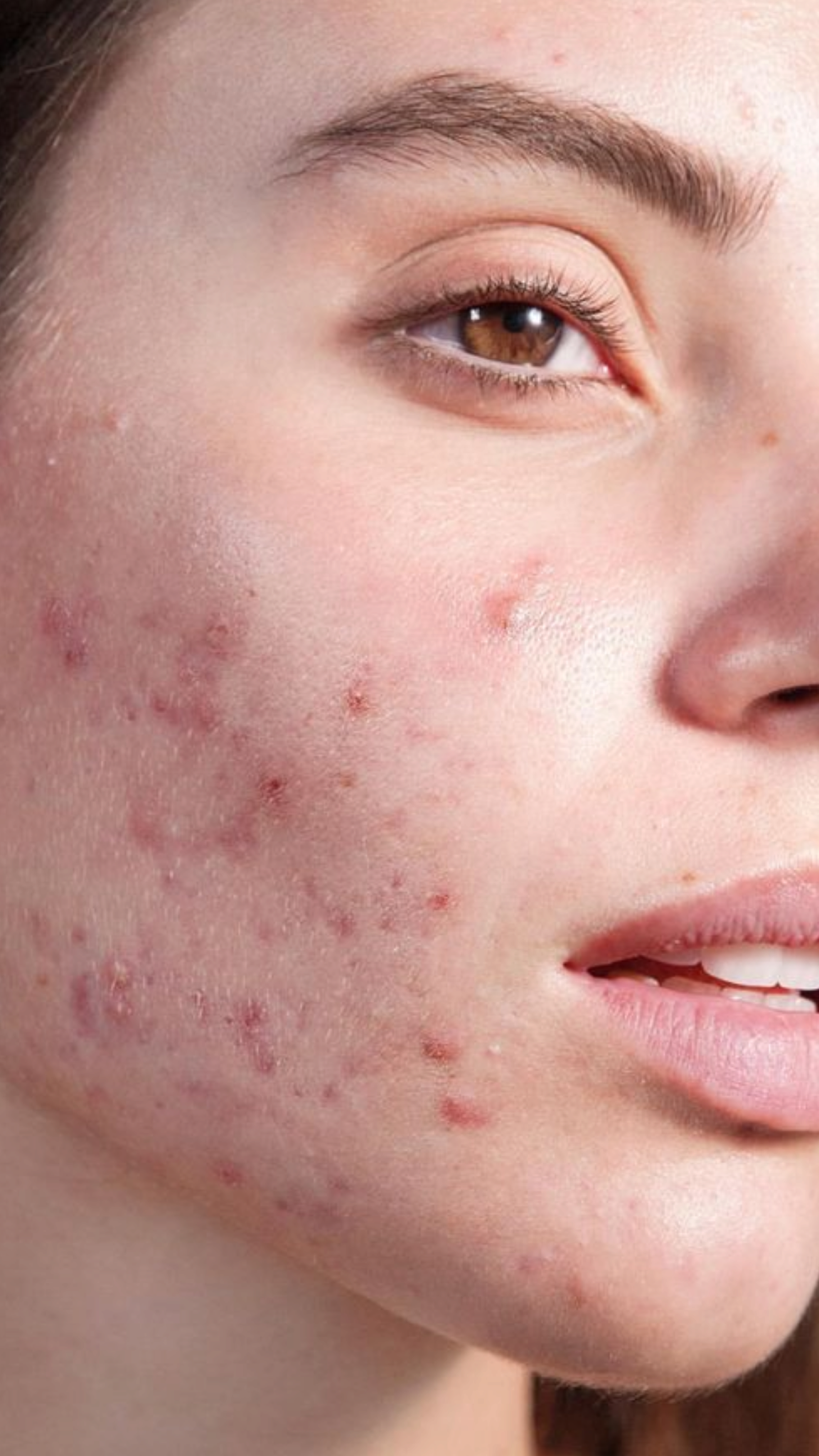 Clean skin close up perspective visual representation