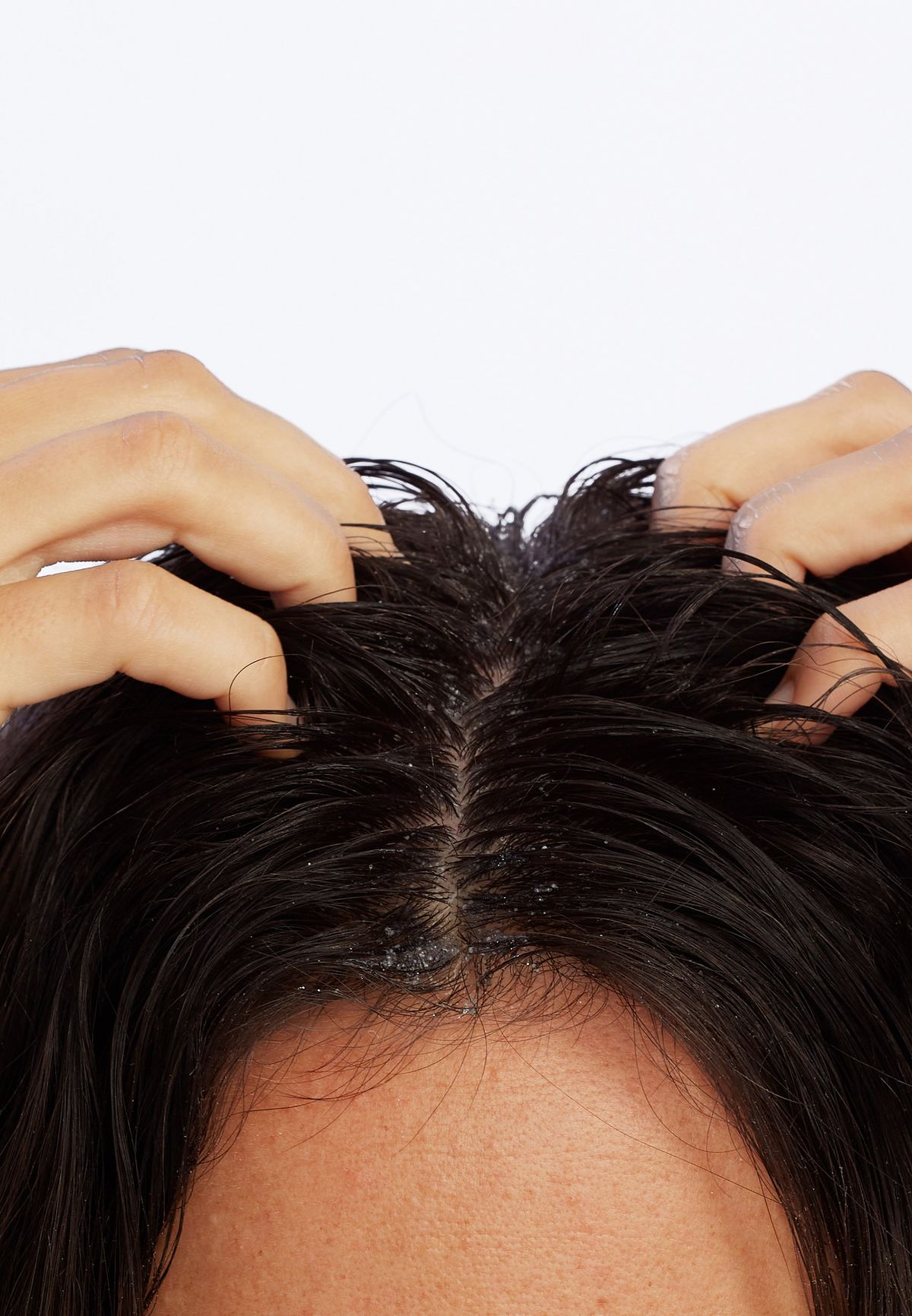 Hair Regrowth & Dandruff Treatment