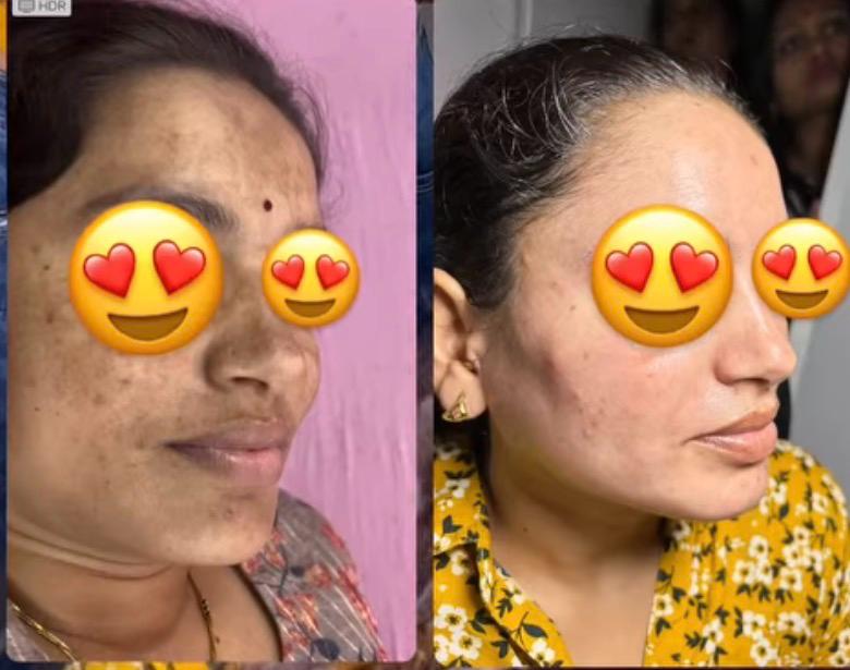 Skin Diagnostic Technology