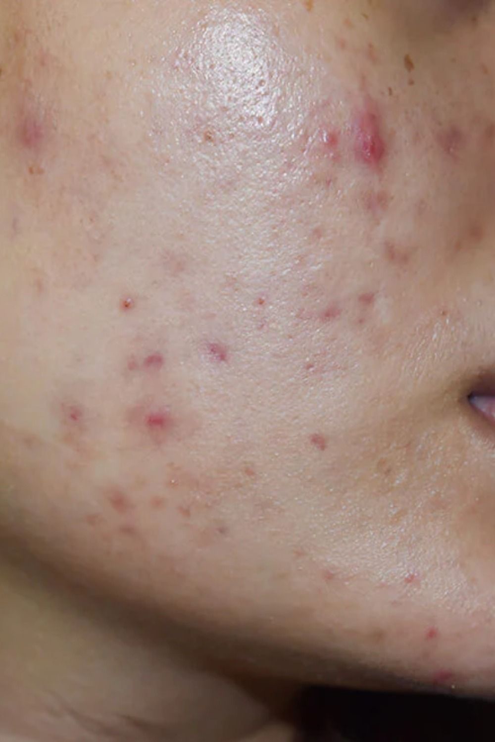 Clinical skincare treatment preparation layout close up